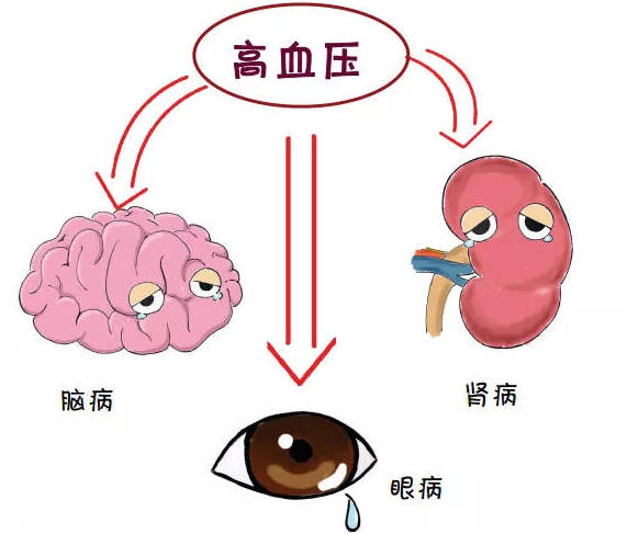 黄连解毒汤加减治高血压病医案、配方