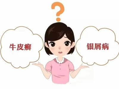 黄连解毒汤加减治银屑病医案、配方