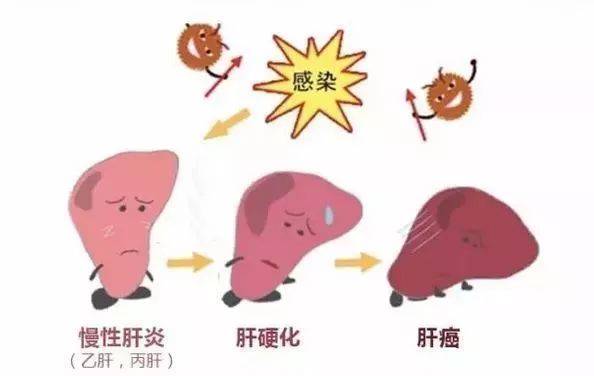 阳和汤加减治慢性肝炎医案、配方