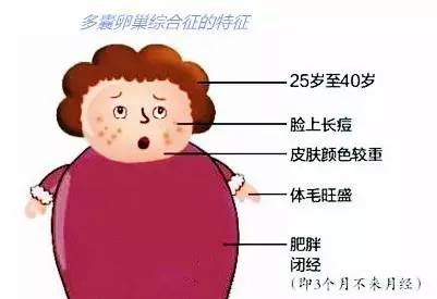 阳和汤加减治多囊卵巢综合征医案、配方