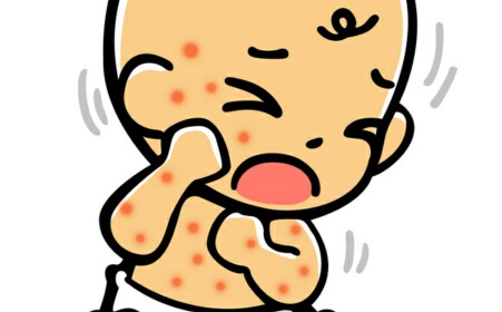 阳和汤加减治血管神经性水肿医案、配方