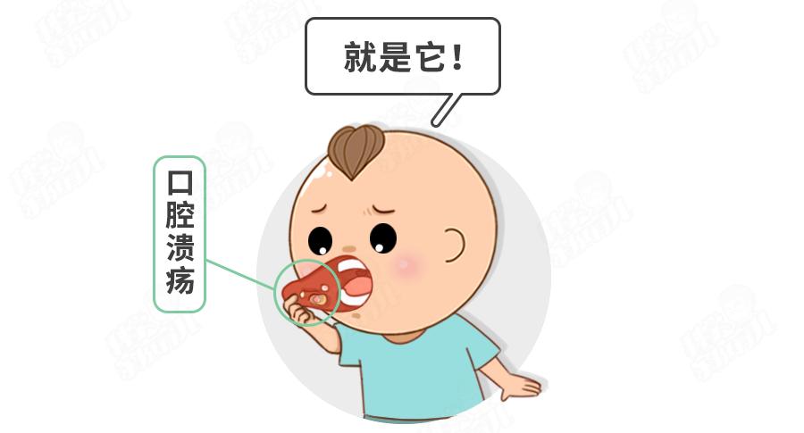 六味地黄丸加减治复发性口腔溃疡医案、配方