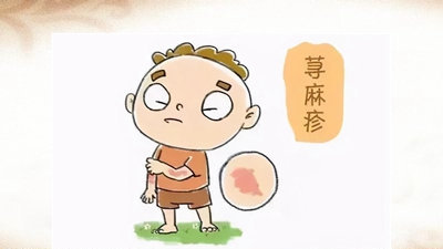 六味地黄丸加减治慢性荨麻疹医案、配方