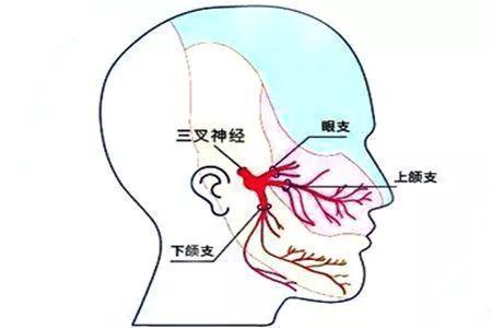 六味地黄丸加减治三叉神经痛医案、配方