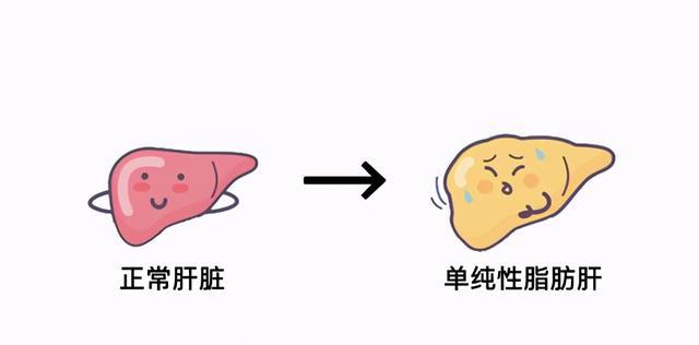 六味地黄丸加减治脂肪肝医案、配方