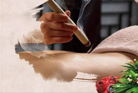 什么是耳针疗法