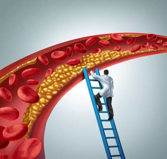 高血脂症如何应用中医药？