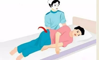 长期卧床病人如何预防褥疮?