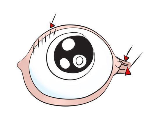 为什么眼疾患者要忌葱蒜