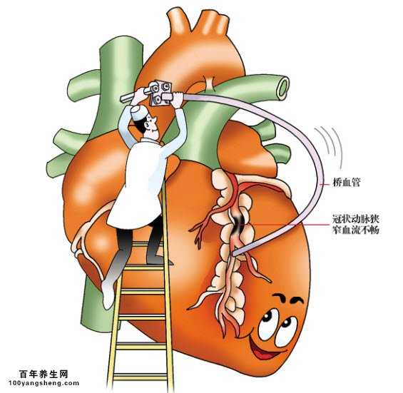 潘生丁治疗冠心病的效果如何？