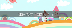 如何治疗“鬼剃头”？