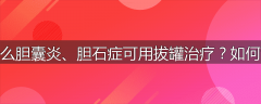为什么胆囊炎、胆石症可用拔罐治疗?如何治疗