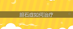 胆石症如何治疗
