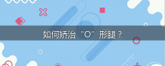 如何矫治“O”形腿？